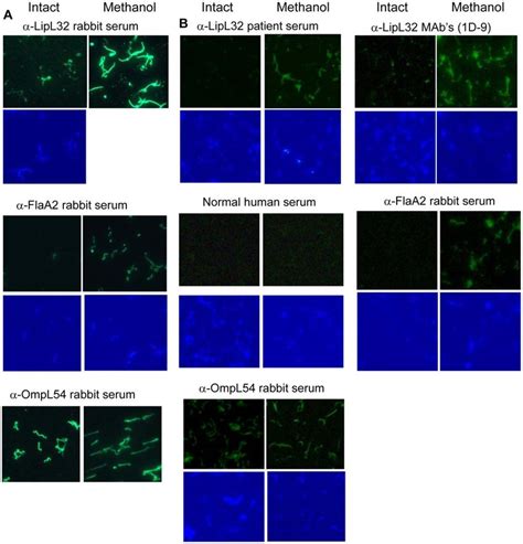 lipl32 leptospirosis